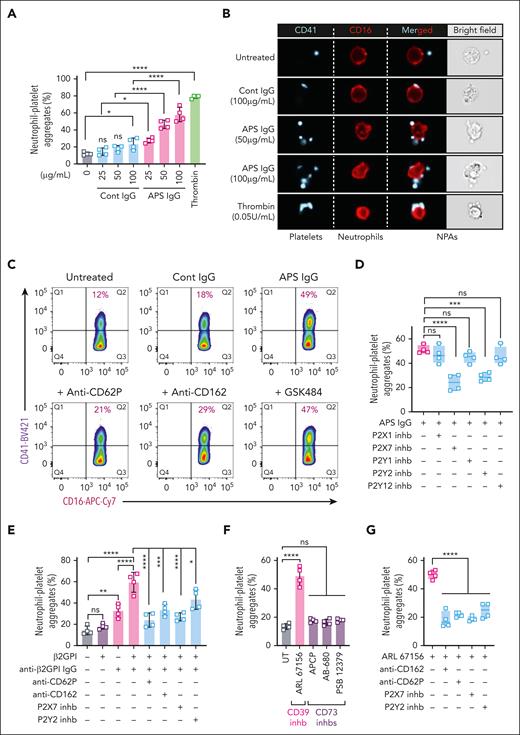The role of P-selectin–PSGL-1 interactions, as well as P2X7 and P2Y2 receptors, in APS-relevant neutrophil-platelet aggregate formation. (A) Cocultures of washed neutrophils and platelets (1:20) from healthy volunteers were treated with various concentrations of control IgG or APS IgG for 1 hour and neutrophil-platelet aggregates (CD15+CD16+CD41+) were quantified by flow cytometry. Thrombin (0.05 U/mL) served as a positive control. (B) Representative ImageStream flow cytometry images using conditions similar to panel A. (C) Representative flow cytometry dot plots of neutrophil-platelet aggregate formation in response to control (50 μg/mL) or APS IgG (50 μg/mL); some samples were additionally pretreated for 15 minutes with anti-CD62P (anti–P-selectin, 2 μg/mL), anti-CD162 (anti–PSGL-1, 2 μg/mL), or GSK-484 (NETosis inhibitor, 10 μM). (D) Neutrophil-platelet cocultures were pretreated with inhibitors of P2X1 (NF 279, 2 μM), P2X7 (AZD9056, 10 μM), P2Y1 (MRS2179, 50 μM), P2Y2 (AR-C 118925XX, 10 μM), or P2Y12 (AR-C 69931, 10 μM) followed by 1 hour of treatment with APS IgG (50 μg/mL). Aggregates were quantified by flow cytometry as above. (E) Neutrophil-platelet cocultures were treated with β2GPI protein and affinity-purified anti-β2GPI IgG from patients with APS, along with blockers of P-selectin, PSGL-1, P2X7, or P2Y2. Aggregates were quantified as above. (F) Neutrophil and platelet cocultures were treated with inhibitors of ectonucleotidases CD39 (ARL 67156, 100 μM) or CD73 (APCP, 100 μM; AB-680, 10 μM; PSB 12379, 100 μM) for 1 hour. (G) Neutrophil and platelet cocultures were pretreated with blockers of P-selectin, PSGL-1, P2X7, or P2Y2 before treating with the CD39 inhibitor for 1 hour. Aggregates were quantified as above. ∗P < .05, ∗∗P < .01, ∗∗∗P < .001, ∗∗∗∗P < .0001, and ns: nonsignificant by one-way ANOVA followed by the Tukey multiple comparisons test.