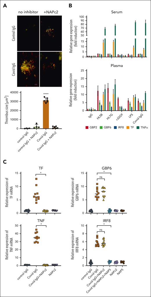 Inhibition of aPL prothrombotic and proinflammatory response by NAPc2. (A) Thrombus formation in mice treated with immunoglobulin (10 μg) fractions either alone or together with NAPc2; platelets are shown in red, and leukocytes are shown in green. Quantification of thrombus size in the vena cava inferior 3 hours after injection of immunoglobulin isolated from healthy controls (n = 4) or patients with COVID-19 (n = 6) and flow restriction. Mean ± standard deviation (SD), ∗∗∗∗P < .0001, t test following Shapiro-Wilk test for normal distribution. (B) MM1 cells were cultured in human serum or plasma and then stimulated for 1 hour with HL5B or HL7G (400 ng/mL each), rJGG9 or IgG (1 μg/mL each), LPS (10 ng/mL) or IgG from patients with COVID-19 (10 μg/mL). (C) Suppression of TF, TNF, GBP6 and IRF8 mRNA induction by NAPc2 (200 nM) and NAP5 (200 nM) after 1 hour of stimulation with immunoglobulin (10 μg/mL) isolated from patients with COVID-19 (n = 10), ∗P < .0001; 1-way analysis of variance (ANOVA).