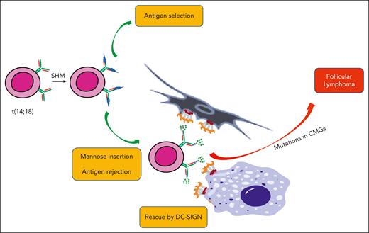 The potential influence of mandatory oligomannoses inserted into the BCR during the development of FL. The first event in the bone marrow is t(14;18) translocation, which upregulates BCL2. These B cells then, apparently, undergo somatic hypermutation (SHM) and antigen selection. There is a likely bifurcation of cells that are able to bind antigen and those that have acquired oligomannoses in the BCR, which cannot undergo antigen selection. These “rejects” may be lost or could be rescued by DC-SIGN on FDCs and/or macrophages, forming a population awaiting mutations in chromatin-modifying genes (CMGs) to drive lymphomagenesis.