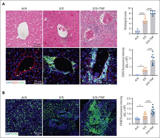 Increased inflammatory infiltrates and altered macrophages in the liver of S/S mice. (A) Representative images of hematoxylin and eosin staining and immunofluorescence staining of liver sections from A/A mice, S/S mice, and S/S mice during VOEs. There were increased vaso-occlusion, inflammatory infiltrates, and hepatocyte death in the liver of S/S mice, which were further aggravated during TNF-induced VOE. Histological scores and inflammatory infiltrate quantification are shown on the right. Cryosections were stained with primary antibodies to CD31 (endothelial cell marker) and CD45 (leukocyte common antigen). 4′,6-diamidino-2-phenylindole (DAPI) cell nuclear staining (n = 4 mice per group). Data represent mean ± standard deviation. ∗P < .05; ∗∗∗P < .001; ∗∗∗∗P < .0001, 1-way analysis of variance (ANOVA). (B) Representative confocal microscopic images of liver cryosections of A/A mice, S/S mice, and S/S mice during VOEs. There were increased macrophages in the S/S mouse liver, which were hypertrophied when compared with those in the liver of A/A mice. During VOE, there was an increase of macrophage accumulation around the vessels in the liver of S/S mice, indicating increased infiltration of circulating monocyte-derived macrophages. Macrophage quantification is shown on the right. Cryosections were stained with primary antibody to F4/80 (macrophage marker). DAPI cell nuclear staining (n = 4 mice per group). Data represent mean ± standard deviation. ∗P < .05; ∗∗∗P < .001, 1-way ANOVA. AU, arbitrary unit.