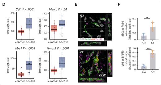 Macrophage transcriptomic profiling shows enhanced macrophage scavenging activity in the liver of S/S mice. (A) Five macrophage subsets identified by MERFISH of liver tissues from 1.5-month-old A/A and S/S mice at baseline, visualized in UMAP (white-line boxed inset) and liver tissues in situ. Each color represents 1 macrophage subtype. Each dot represents 1 cell. These images show significantly increased monocytes or macrophages in the liver of S/S mouse, with remarkable accumulation around the vessels. (B) Comparisons of hepatic spatial transcriptomic profiles between 1.5-month-old A/A and S/S mice using the 300-general inflammation and thrombosis MERFISH gene panel. Each color and its corresponding RNA species are shown in the gene color key box on the right. Each dot represents 1 RNA molecule. (C) Comparisons of hepatic macrophage transcriptomic profiles between 4 groups of mice, 2-month-old A/A and S/S mice at baseline and 2-month-old A/A and S/S mice after TNF challenge using the 140-monocyte or macrophage MERFISH gene panel. Each color and its corresponding RNA species are shown on the right in the gene color key box. Each dot represents 1 RNA molecule. (D) Quantifications of transcript numbers per cell for Csf1, Marco, Mrc1, and Hmox1 genes between the livers of A/A and S/S mice in (C). Welch 2-sample t test. (E) Three-dimensional (3D) rendering of confocal images showing the clearance of VWF and erythrocytes by macrophages in the liver of A/A and S/S mice. Side views are shown on the right and bottom. DAPI cell nuclear staining (n = 3 mice per group). (F) Quantification of the colocalization of F4/80+ macrophages with VWF (bottom) and erythrocytes (top). These images demonstrate the increased clearance of VWF and erythrocytes by macrophages in the liver of S/S mice. Data represent mean ± standard deviation. ∗∗P < .01; ∗∗∗∗P < .0001, 2-tailed, unpaired Student t test. F4/80, macrophage marker; RBC, red blood cell; Ter119, erythrocyte marker.
