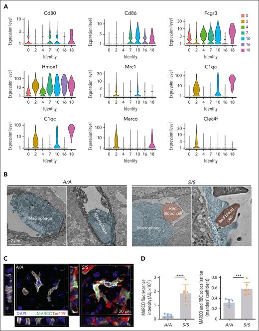Clec4f+Marcohigh macrophages are important for erythrocyte clearance. (A) Comparisons of the expression levels of proinflammatory and anti-inflammatory markers in 7 distinct macrophage subsets identified by scRNA-seq of liver cells from TNF-challenged 2-month-old A/A (n = 2) and S/S mice (n = 2). Among them, the Clec4f+ Kupffer cells expressed higher levels of Mrc1 and Marco than of other groups, identifying them as restorative macrophages. (B) Representative transmission electron microscopic images showing increased erythrophagocytosis in hepatic macrophages of S/S mice than those in A/A mice. There were dramatically increased interactions between erythrocytes (red) and macrophages (blue) and phagocytosis of erythrocytes by macrophages in the liver of S/S mice. (C) 3D rendering of confocal images showing the clearance of erythrocytes by macrophages in the liver of A/A and S/S mice. Side views are shown on the left and bottom. The sections were stained with primary antibodies to MARCO (a scavenger receptor), macrophages (F4/80), and erythrocytes (Ter119). There was a dramatic increase of Marcohigh macrophages in the liver of S/S mice and these Marcohigh macrophages showed increased clearance of erythrocytes in the liver of S/S mice. DAPI cell nuclear staining (n = 3 mice per group). (D) Quantification of MARCO fluorescence intensity (left) and the colocalization of MARCO+ macrophages with erythrocytes (right). Data represent mean ± standard deviation. ∗∗∗P < .001; ∗∗∗∗P < .0001, 2-tailed, unpaired Student t test.