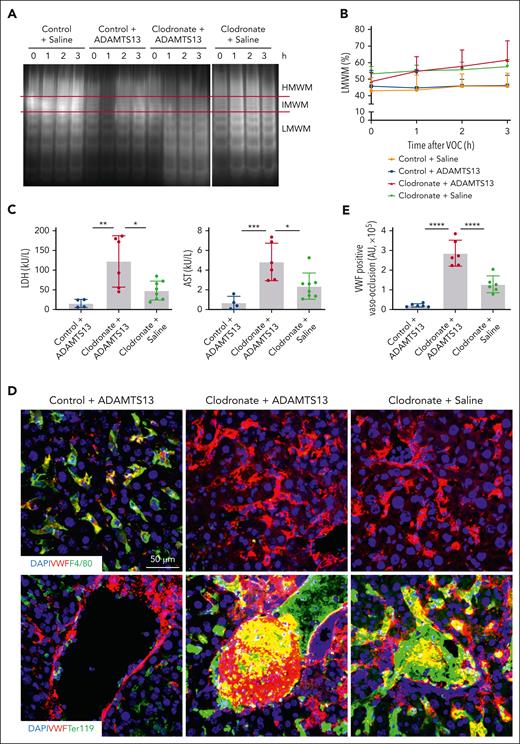 Macrophages are required for the protective effect of ADAMTS13. (A) Plasma VWF multimeric compositions from 4 groups of S/S mice at basal level and at different time points after VOE induction (1, 2, and 3 hours). Control + saline, S/S mice treated with saline and control liposomes; control + ADAMTS13, S/S mice treated with ADAMTS13 and control liposomes; clodronate + ADAMTS13, S/S mice treated with ADAMTS13 after clodronate-mediated macrophage depletion; and clodronate + saline, S/S mice treated with saline after clodronate-mediated macrophage depletion. Data represent at least 4 independent experiments. HMWM, IMWM, or LMWM represents high, intermediate, or low molecular weight VWF multimers, respectively (denoted by red lines). (B) The percentage of LMWM among total VWF at each time point was quantified based on densitometry. Data represent at least 4 independent experiments. (C) Plasma levels of lactate dehydrogenase (LDH) and aspartate transaminase (AST) at 3 hours after VOE induction in different groups of S/S mice treated as described in panel A. Each dot represents 1 mouse. Data represent mean ± standard deviation. ∗P < .05; ∗∗P < .01; ∗∗∗P < .001, 1-way ANOVA. (D) Representative confocal microscopic images of liver cryosections from different groups of S/S mice. These sections were stained with primary antibodies to VWF, macrophages (F4/80), and erythrocytes (Ter119). DAPI cell nuclear staining. The top panel shows efficient depletion of F4/80-positive macrophages in clodronate-treated mice. Bottom panel highlights that ADAMTS13 reduced VWF-positive vaso-occlusion and colocalization (yellow) of VWF with sickle erythrocytes (Ter119), which was abolished by clodronate-mediated depletion of macrophages. Data represent at least 4 independent experiments. (E) Quantification of VWF-positive vaso-occlusions in (D). Data represent at least 4 independent experiments. Data represent mean ± standard deviation. ∗∗∗∗P < .0001, 1-way ANOVA.