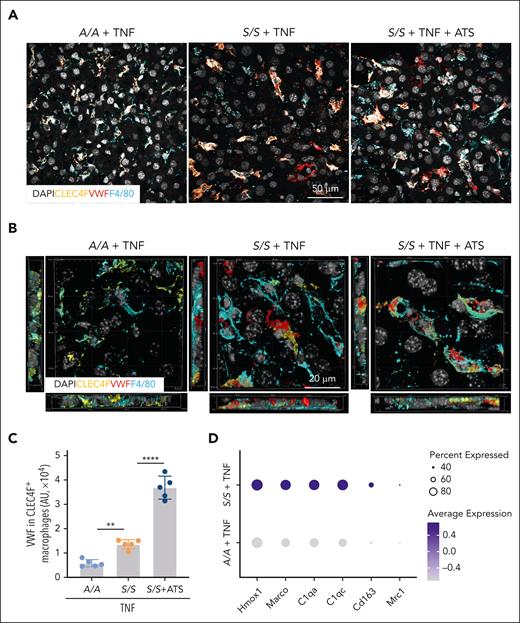 Clec4f+ Kupffer cells are an important restorative macrophage subset with increased VWF clearance activity. (A) Representative confocal microscopic images and (B) 3D rendering of confocal images of liver cryosections from TNF-challenged A/A mice, S/S mice, and S/S mice with ADAMTS13 (ATS) treatment. The sections were stained with primary antibodies to VWF, CLEC4F (Kupffer cell marker), and F4/80 (macrophage marker) (n = 5 mice per group). DAPI cell nuclear staining. (C) Quantification of the amount of VWF in CLEC4F+ macrophages of the 3D rendering confocal images in (B) (ie, cells stained positive for both VWF and CLEC4F). There was increased clearance of VWF in CLEC4F+ macrophages in the S/S mouse liver, which further increased after ATS treatment. Data represent mean ± standard deviation. ∗∗P < .01; ∗∗∗∗P < .0001, 1-way ANOVA. (D) Representative differentially expressed genes related to scavenging and anti-inflammatory functions between Kupffer cells from A/A and S/S mice challenged with TNF. For scRNA-seq, n = 2 mice per group.