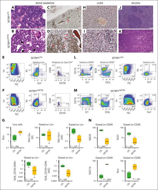 Pathology of SETBP1G870S mouse. (A-B) H&E staining of age-matched (3 months) SETBP1LSL (A) and SETBP1G870S (B) BM (scale bars, 25 μm). In controls, BM sections showed a normal granulocytes segmentation with mature polylobulated megakaryocytes. In diseased mice, myeloid differentiation was abnormally shifted to the left and frequent atypical megakaryocytes were seen (black arrows). (C-D) BM sections stained with Gomori silver stain in a SETBP1LSL (C) and a SETBP1G870S (D) mouse at 150 days of age (scale bar, 25 μm). An increased network of reticulin fibers with many intersections can be noted in SETBP1G870S. The red arrows point to thick, confluent fibers. Control BM shows normal reticulin structure; the small arrow points to normal perivascular staining as an internal positive control. (E-F) FACS analysis of BM cells from representative SETBP1LSL (E) and SETBP1G870S (F) mice. CD45+ cells were stained with myeloid, lymphoid, and stem cell markers, as indicated. (G) Aggregated data from FACS analysis of BM samples (n = 5). (H-K) H&E-stained histological sections of the liver (H-I; scale bars, 25 μm) and spleen (J-K; scale bars, 100 μm) of SETBP1LSL (H,J) and SETBP1G870S (I,K) mice. In both organs, SETBP1G870S mice showed subversion of the normal parenchyma with accumulation of myeloid cells and evidence of extramedullary hematopoiesis. Clusters of myeloid elements were present in the liver, with periportal distribution. Red pulp colonization in the spleen showed clusters of abnormal megakaryocytes with hypercondensed chromatin; also, numerous bare megakaryocytic nuclei were present. (L-M) FACS analysis of spleen cells from SETBP1LSL (L) and SETBP1G870S (M) mice. CD45+ cells were stained with myeloid, lymphoid, and progenitor cell markers, as indicated. (N) Aggregated data from FACS analysis of splenocytes (n = 5).
