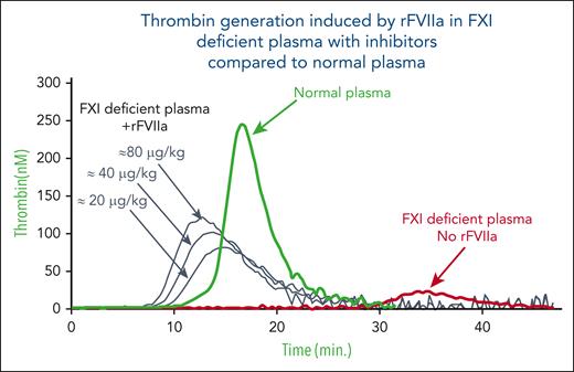 Thrombin generation in FXI-deficient plasma with inhibitors: ex vivo spiking with increasing concentrations of rFVIIa. This representative figure shows TGAs performed in our laboratory in the presence of FXI-deficient plasma (and FXI inhibitor) as compared with normal plasma. Ex vivo spiking with increasing concentrations of rFVIIa only slightly improved TGA parameters in FXI-deficient plasma. These experiments support the use of low-dose rFVIIa for the treatment of patients with FXI deficiency in order to mitigate thrombotic risks (for more details, refer to Livnat et al81).