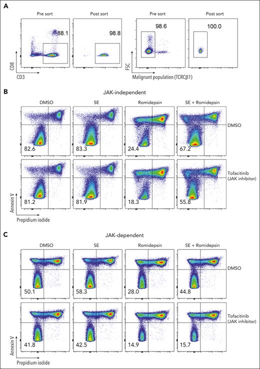 SE induce drug resistance in purified malignant T-cell cultures via JAK-dependent or -independent mechanisms. (A) Flow cytometric plot showing percentage of malignant T cells before and after sorting of PBMCs from SS4. (B-C) Flow cytometric plots showing percentage of viable malignant cells from sorted malignant T cells treated with 2 nM romidepsin for 72 hours in the presence or absence of SE and JAK inhibitor (1 μM tofacitinib) of patient exhibiting JAK-independent (SS13) (B) and JAK-dependent (SS4) (C) resistance being induced by the presence of SE. DMSO, dimethyl sulfoxide.