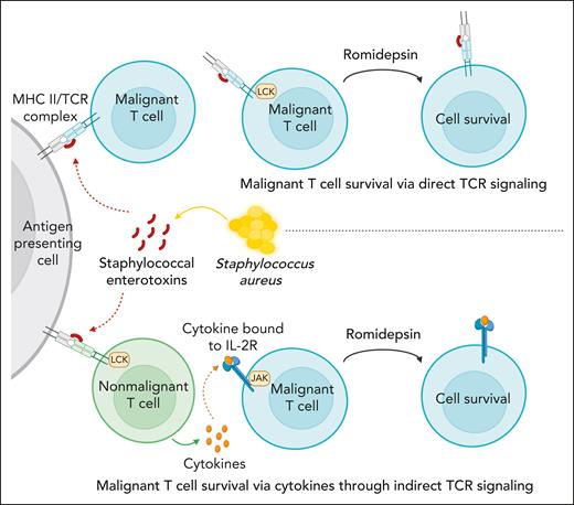S aureus induces drug resistance in malignant T cells through direct and indirect TCR activation.S aureus can induce drug resistance in malignant T cells through secretion of SE using 2 distinct pathways: (1) direct TCR-dependent, JAK-independent pathway mediated through PKC-dependent NF-κB signaling (upper part), and (2) an indirect JAK-dependent pathway, which relies on SE-induced cytokine production in bystander T cells or the malignant cells themselves in an auto/paracrine fashion (lower part).