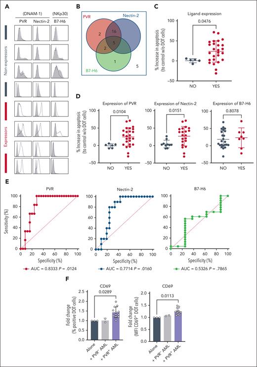 Expression of PVR but not B7-H6 predicts cytotoxic targeting of primary AML samples by DOT cells. (A) Representative flow cytometry histograms of the expression of PVR, nectin-2, and B7-H6. Each row depicts a different AML sample donor. Gray histograms, isotype; black lines, sample. (B) Distribution of PVR, nectin-2, and B7-H6 expression on all primary AML samples analyzed. (C) Targeting of primary AML samples by DOT cells based on the expression of 1 of 3 ligands shown in panels A-B. (D) Targeting of primary AML samples by DOT cells based on the expression of PVR, nectin-2, or B7-H6. (E) Receiver operating characteristic curves that illustrate the predictive ability of the expression of each of the depicted ligand(s) to discriminate whether primary AML samples are targeted by DOT cells. (F) Fold change of percentage of CD69+ cells (left) or CD69 MFI (right) on DOT cells that were cultured alone, or in the presence of PVR− or PVR+ primary AML samples. Each dot represents a different DOT cell/AML combination. Statistical analysis was performed using the Mann-Whitney U test for panels C-D, and Kruskal-Wallis followed by Dunn multiple comparisons test for panel E. AUC, area under the curve; w/o, without.