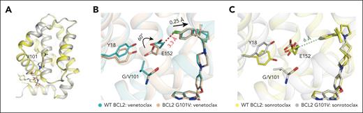 Crystal structure of the BCL2 G101V mutant in complex with sonrotoclax. (A) Comparison of the structures of WT BCL2 (yellow) and the G101V mutant (gray) in complex with sonrotoclax. (B-C) Conformational changes of residues around G/V101 in the crystal structures of WT BCL2 and G101V in complex with venetoclax (B) and sonrotoclax (C). The complex structures of BCL2:venetoclax (PDB ID: 6O0K) and BCL2 G101V:venetoclax (PDB ID: 6O0L) are shown in cyan and light orange, respectively. The minimum distances between E152 of the BCL2 G101V mutant and the compounds are indicated by green and red dashed lines.