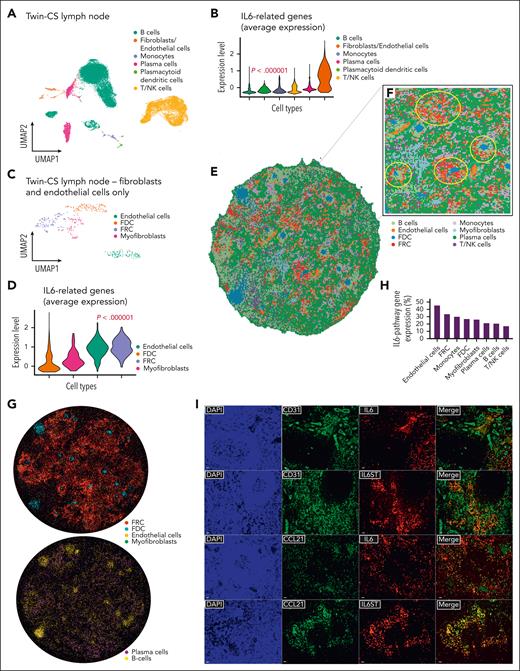 Single-cell transcriptomic sequencing identifies nodal endothelial and FRCs expressing IL-6–related genes. (A) UMAP plot of 25 445 cells from the affected lymph node of Twin-CS demonstrating distinct clusters by cell types, with a majority of B cells, followed by T/NK cells, plasma cells, and others. (B) Violin plot showing the average expression of IL-6 pathway genes (IL6, IL6ST, OSMR, and LIFR) was strongest in the nodal endothelial cells and fibroblasts (2-tailed P < .000001; Kruskal-Wallis test). (C) UMAP plot of 406 cells identified as fibroblasts and endothelial cells from the affected lymph node of Twin-CS showing 4 distinct clusters, with the fibroblast compartment further segregated into FRCs, follicular dendritic cells (FDCs), and myofibroblasts. (D) Violin plot showing the average expression of IL-6 pathway genes were most prominent in FRCs and endothelial cells (2-tailed P < .000001; Kruskal-Wallis test). (E) Cell-type annotation on the spatial enhanced resolution omics sequencing (Stereo-seq) bin50 data encompassing the same cell types identified on single-cell RNA-sequencing (scRNAseq) analysis of affected lymph node of Twin-CS. (F) Enlarged region showing enrichment of endothelial cells corresponding to vascular structures (circled in cyan), whereas follicle structures (circled in yellow) were enriched in B cells and FDCs, and surrounded by FRCs, endothelial cells, and other cell types. (G) After a cell segmentation approach (bin 20, 15 μm diameter), cell-type specific markers similarly annotated them to their expected regions on the spatial map. (H) The proportion of cells expressing IL-6–pathway genes (IL6, IL6ST, OSMR, and LIFR) above the threshold (Q3, third quartile) within each cell type as annotated on bin50 data as shown in panel E. (I) Lymph node tissue of Twin-CS demonstrated IL-6 and IL-6ST coexpression with endothelial cells (CD31+) and FRCs (CCL21+) on double immunofluorescence (scale bars, 20 μm). NK cell, natural killer cell; UMAP, uniform manifold approximation and projection.