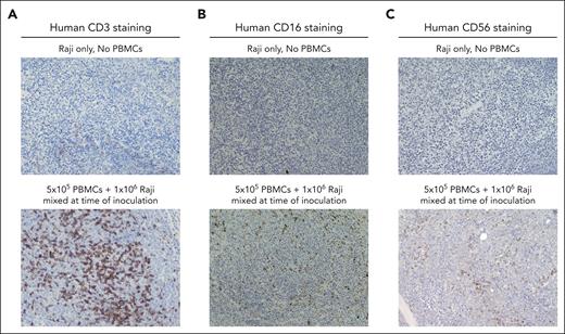 Emerging tumors exhibit uniform distribution of T cells and NK cells in the TME. Humanized mouse xenograft tumors were harvested 27 days after tumor inoculation. IHC staining for hematoxylin and eosin, along with specific markers for CD3 (A), CD16 (B), and CD56 (C), was used to assess the distribution of immune cells within the TME.