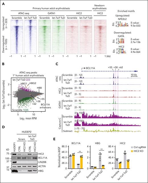 let-7 regulates BCL11A and HBG through inhibition of HIC2. (A) Heatmaps of differentially regulated ATAC-seq peaks of let-7a/f inhibited primary human adult erythroblasts. The HIC2 ChIP-seq of newborn erythroblasts was obtained from previously published data.14 Motifs enriched in up- and downregulated peaks are indicated on the right. (B) MA-plot of ATAC-seq peaks of let-7a/f inhibited primary human adult erythroblasts. Up- and downregulated peaks are highlighted in purple and green, respectively. HBG1/2 and BCL11A enhancers are highlighted in yellow. (C) ATAC-seq, HIC2 and GATA1 ChIP-seq tracks of let-7a/f inhibited primary human adult erythroblasts at BCL11A locus. Capture-C demonstrating interactions from a BCL11A promoter viewpoint, with subctraction track highlighting differences between scramble and let-7a/f decoy samples. (D) Western blot from rescue experiments with concurrent HIC2 depletion and let-7a/f decoy expression. (E) BCL11A, HBG, and HIC2 mRNA measured by qRT-PCR from rescue experiments with concurrent HIC2 depletion and let-7a/f decoy expression in HUDEP2 cells. Results are normalized to AHSP and shown as mean ± SD (2 independent biological replicates with 2 technical replicates each). RPM, reads per million.