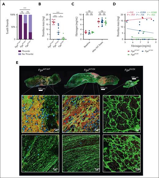 FgaEK/EK and FgaWT/EK mice are protected from venous thrombosis. (A) Incidence of thrombus formation and (B) thrombus weights from FgaWT/WT, FgaWT/EK, and FgaEK/EK mice 24 hours after IVC ligation (stasis model). (C) Circulating fibrinogen levels of before and after IVC ligation measured by enzyme-linked immunosorbent assay. (D) Spearman correlation analysis of circulating fibrinogen level after ligation, and thrombus mass. Data are presented as the mean ± SEM and analyzed using Kruskal-Wallis test. (E) Representative images of 5-μm-thick sections of thrombi stained against fibrin(ogen) (green), CD41 (red), and DAPI (4′,6-diamidino-2-phenylindole) (blue). Note that FgaEK/EK thrombi contained minimal platelets and nucleated cells as well as morphologically distinct aggregates of fibrinogen compared with FgaWT/WT and FgaWT/EK thrombi that display web-like fibrin matrixes. ∗P < .05; ∗∗∗P < .001.