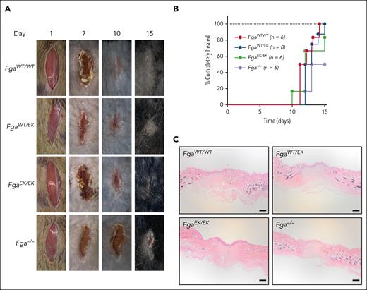 FgaWT/EK and FgaEK/EK mice have normal wound healing. (A) Representative images of wound fields and (B) plot of the percentage of mice healed after 1-cm surgical incision in FgaWT/WT (n = 6), FgaWT/EK (n = 8), FgaEK/EK (n = 6), and Fga−/− (n = 6) mice. Data were analyzed using Kaplan-Meier log-rank test with P < .05 for FgaWT/WT mice vs Fga−/− mice and for FgaWT/EK mice vs Fga−/− mice. (C) Representative images of hematoxylin and eosin–stained 5-μm-thick sagittal sections of wound sites of FgaWT/WT, FgaWT/EK, FgaEK/EK, and Fga−/− mice that healed 15 days after incision; scale bar, 200 μm.