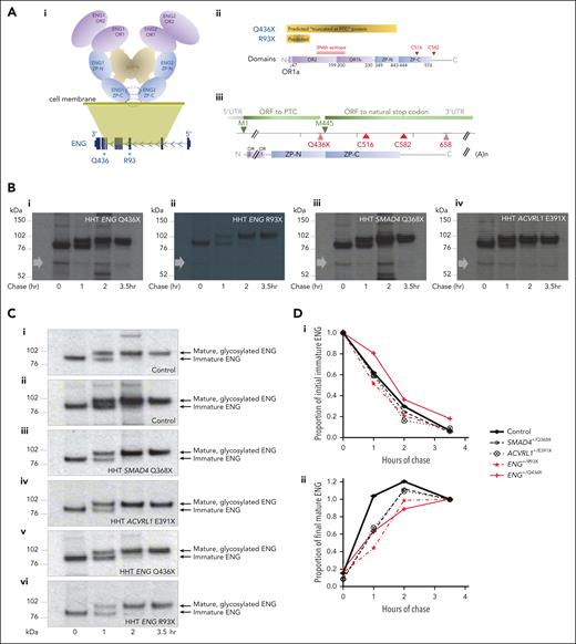 ENG protein expression in normal and HHT endothelial cells. (A) Schematic representations of ENG protein. (i) Domain organization of the ENG protein ectodomain in its BMP-binding homodimeric conformation, in relation to its genomic DNA origin, with OR domains highlighted in purple and ZP domains in blue. Q436 is distal to OR domains OR1 and OR2, but proximal to intermolecular dimerization cysteines C516 and C582 located within and after the ZP-C domain, respectively.72 For simplicity, the single-spanning C-terminal transmembrane domain of ENG (residues 587-611) is not shown. (ii) “Predicted” PTC-truncated ENG Q436X and R93X proteins in relation to the domains and SN6h epitope of wild-type ENG.72,83 (iii) ENG Q436X open reading frames from methionine 1 (M1) to PTC, and M445 to natural stop codon. (B) Pulse-chase experiments in which BOEC lysates were size fractionated on a reducing gel, and overexposed to optimize detection of minor, smaller bands. The approximate position of the Q436X protein that should be detectable by the 35S-labeled SN6h antibody is indicated by a gray arrow in BOECs heterozygous for (i) ENG Q436X, (ii) ENG R93X, (iii) SMAD4 Q368X, and (iv) ACVRL1 E391X. Note, no difference in patterns of sub–full length proteins in HHT BOECs, providing no evidence for a Q436X-specific truncated protein product at expected size based on truncation at the PTC (for full gel data see supplemental Figure 10). (C) Comparison of maturation patterns of full-length ENG protein after pulse-chase in BOECs heterozygous for (i-iv) ENG+/+ (wild-type) controls, and (v-vi) ENG+/PTC BOECs: (i) control A; (ii) control B; (iii) SMAD4 Q368X; (iv) ACVRL1 E391X, (v) exon 10 ENG Q436X, and (vi) exon 3 ENG R93X. (D) Densitometry analyses of the immunoblots in panel C. (i) Lower band (immature ENG) densitometry values across the 4 chase time points. By 2-way ANOVA, time accounted for 72.5% of variation (P < .0001), ENG vs non-ENG genotypes for 1.8% (P = .049), and the interaction term for 0.98% (P = .092). (ii) Upper band (mature ENG) densitometry values across the 4 chase time points. By 2-way ANOVA, time accounted for 64.3% of variation (P < .0001), ENG vs non-ENG genotypes for 1.4% (P = .54), and the interaction term for 3.5% (P = .26).