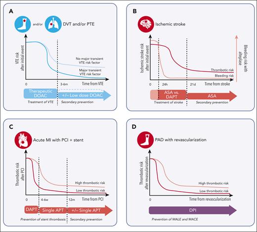 Illustration of the thrombotic risk and antithrombotic treatment approach for common thrombotic conditions. Diagnoses include (A) VTE, (B) ischemic stroke, (C) acute myocardial infarction with percutaneous coronary intervention and stent placement, and (D) PAD with revascularization. Red circles represent an arterial thrombotic event of the pictured organ and blue circles represent a venous thrombotic event. Time on the x-axis is approximated and not to scale, with time 0 representing the occurrence of the thrombotic event. Antithrombotic therapies are distinguished by colors, with red representing antiplatelet therapy, blue representing anticoagulation, and purple representing combination of anticoagulation and antiplatelet therapy. APT, antiplatelet therapy; ASA, aspirin; MI, myocardial infarction.