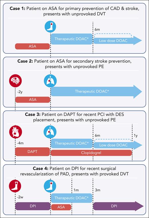 Timeline of antithrombotic therapy for discussed cases. For each case, the red circle represents the arterial thrombotic event, and the blue circle represents the venous thrombotic event. Time indicators reflect occurrence of events relative to the venous thrombotic event. Antithrombotic therapies are distinguished by colors, with red representing antiplatelet therapy, blue representing anticoagulation, and purple representing a combination of anticoagulation and antiplatelet therapy. ∗For all patients receiving therapeutic dose oral Xa inhibitors for venous thrombosis, an initiation dose is recommended (per package insert, and presented in Table 1). ASA, aspirin.