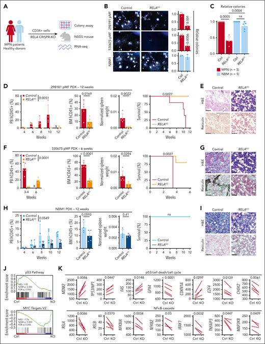 Conserved RELA dependency in patient-derived MPN mouse models. (A) Schematic of the primary sample models and downstream assays after RELA perturbation. (B) Colony assay of CD34+ cells after RELA knockout (KO). Representative images (left). Relative numbers (right, n = 3 biological replicates). Statistics were assessed by 2-tailed Student’s t test. (C) Relative colony numbers after RELA knockout from additional unique patients with MPN (n = 5) and NBM donors (n = 5). Statistics were assessed by 2-tailed Student’s t test comparing MPN and NBM after taking an average of each 3 biological replicates per sample. (D-I) Leukemic engraftment in the PB, BM at end point, normalized spleen weights, survival curves, and BM histology in the 298181 primary MF (D-E; n = 5 mice per group), 530675 primary MF (F-G; n = 5 mice for control, n = 4 for RELAKO), and NBM1 (H-I; n = 4 mice for control, n = 5 for RELAKO) PDX models. PB human CD45+ (hCD45+) cells statistics assessed by 2-way ANOVA. BM hCD45+ and normalized spleen weights statistics assessed by 2-tailed Student t test. Survival curves assessed by log-rank test. Scale bar = 75 μm. (J) Gene set enrichment analysis scores after RNA sequencing analysis of 4 paired MPN samples after RELA knockout. (K) Expression of pertinent genes from RNA sequencing data after RELA knockout. Statistics assessed by Wilcoxon matched-pairs signed rank test. ns, nonsignificant; X, no data.