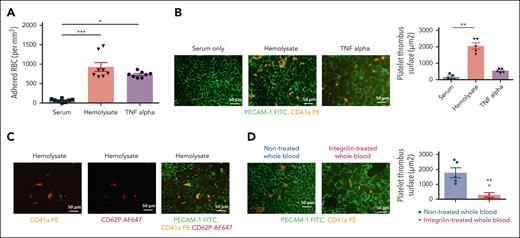 Hemolysate induced HUVEC dysfunction. HUVECs cultured in a flow system were exposed to either AA hemolysate, TNFα, or serum for 4 hours. Functional assays were performed by infusing heparinized WB on hemolysate-preconditioned HUVECs for 10 minutes. The infusion flow rate in the fluidic model was adjusted to reach a shear stress of 1 dyne·cm−2. (A) RBC adhesion after infusion of heparinized WB from AA donors on either AA hemolysate, TNFα, or serum-preconditioned HUVECs for 10 minutes at shear stress 1 dyne·cm−2. Data represent mean ± SEM (n = 8), the Kruskal-Wallis test with ∗P < .05 and ∗∗∗P < .001. (B-C) Platelet aggregation and activation at endothelial injury sites after infusion of heparinized WB from AA donors on either AA hemolysate, TNFα or serum-preconditioned HUVECs for 10 minutes at shear stress 1 dyne·cm−2. (C) Fixed cells were stained with PECAM-1 FITC (green), CD41a PE (orange), and CD62P (mouse antihuman primary antibody and Alexa Fluor 647 goat antimouse secondary antibody, red). Data represent mean ± SEM (n = 5), the Kruskal-Wallis test with ∗P < .05 and ∗∗∗P < .001. (D) Inhibitory effect of integrilin on platelets aggregation. HUVECs cultured in a flow system were exposed to AA hemolysate for 4 hours. AA heparinized WB was pretreated or not with integrilin, a GPIIbIIIa antagonist, at 10 μg/mL for 30 minutes before infusion on hemolysate-preconditioned HUVECs for 10 minutes. The infusion flow rate in the fluidic model was adjusted to reach a shear stress of 1 dyne·cm−2. After the washing step, fixed cells were stained with PECAM-1 FITC (green) and CD41a PE (orange). Images representative of 5 different experiments, data represent mean ± SEM (n = 5) (∗∗) paired t test with P < .01. FITC, fluorescein isothiocyanate.