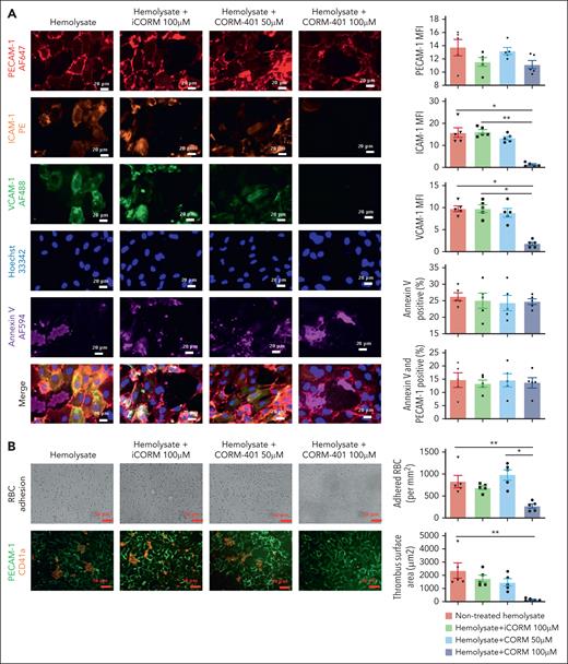 Hemolysate-induced proinflammatory and activation of HUVECs is prevented by CORM-401. HUVECs cultured in a flow system were pretreated or not with either CORM-401 or iCORM at a different concentration for 1 hour before being exposed to either hemolysate alone or hemolysate plus either CORM-401 or iCORM (recapitulated in following table). Nonpretreated HUVECs exposed to hemolysate alone served as control group. The infusion flow rate was adjusted to reach a shear stress of 1 dyne·cm−2 (Table 1). (A) Immunofluorescence staining of membrane markers on HUVECs: PECAM-1 Alexa Fluor 647 (red), ICAM-1 PE (orange), VCAM-1 Alexa Fluor 488 (green), annexin-V Alexa Fluor 594 (purple), phalloidin Alexa Fluor 488 (green), and Hoechst 33442 (blue). Images representative of 5 different experiments. ICAM-1 and VCAM-1 MFI was quantified by ImageJ. Data represent mean ± SEM (n = 5), the Kruskal-Wallis test with ∗P value < .05, ∗∗P < .01, ∗∗∗P < .001, and ∗∗∗∗P < .0001. (B) CORM-401 prevented RBC and platelet recruitment on HUVECs preconditioned with hemolysate. Heparinized WB from AA donors was perfused on preconditioned HUVECs for 10 minutes at shear stress 1 dyne·cm−2. Fixed cells were stained with PECAM-1 FITC (green) and CD41a PE (orange). Images representative of 5 different experiments. Data represent mean ± SEM (n = 5), the Kruskal-Wallis test with ∗P value < .05, ∗∗P < .01.