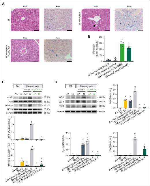 CORM-401 attenuates liver injury in SS mice exposed to hemolysate. (A) Representative micro picture of hematoxylin and eosin (H&E)–stained sections and Perls-stained sections of liver at ×200 magnification from SS mice exposed to SB or hemolysate and treated with either vehicle or CORM-401 (scale bar: 50 mm; see also Table 1). (B) Quantification of CO content in the liver of AA and SS mice treated with either vehicle or CORM-401 (30 mg/kg) by oral gavage. Accumulation of CO in hepatic tissue was measured spectrophotometrically using the hemoCD1 assay. Data are presented as mean ± SEM; ∗P < .02 compared with vehicle-treated animals. (C) Western blot analysis with specific antibodies against phosphorylated (p)-Nrf2, Nrf2, p-NF-κB, and NF-κB, in the liver from AA and SS mice infused with SB or hemolysate and treated with either vehicle or CORM-401. GAPDH is used as protein loading control. One representative gel from 5 with similar results is shown. Densitometric analysis of the immunoblots is shown in the bottom panel. Data are presented as mean ± SEM (n = 5); ^P < .05 compared with vehicle-treated animals; ∗P < .05 compared with AA animals; #P < .05 compared with SS SB-treated animals by the 1-way ANOVA. (D) Western blot analysis with specific antibodies against HO-1, Gpx1, and TBXS in liver from AA and SS mice infused with SB or hemolysate and treated with either vehicle or CORM-401. GAPDH is used as protein loading control. One representative gel from 5 with similar results is shown. Densitometric analysis of the immunoblots is shown in the bottom panel. Data are presented as mean ± SEM (n = 5); ^P < .05 compared with vehicle-treated animals; ∗P < .05 compared with AA animals; #P < .05 compared with SS SB-treated animals by the 1-way ANOVA.