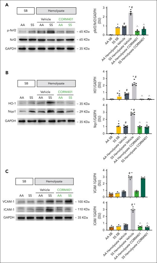 CORM-401 modulates the hemolysate-induced activation of pro-oxidation and proinflammatory pathways in the kidney of SS mice. Western blot analysis with specific antibodies against phosphorylated (p)-Nrf2 and Nrf2 in the kidney from AA and SS mice in steady state and exposed to hemolysate, treated with either vehicle or CORM-401. GAPDH is used as protein loading control; 75 μg/μL of protein loaded on an 8% T, 2.5% C polyacrylamide gel. One representative gel from 5 with similar results is shown. Densitometric analysis of immunoblots is shown on the right. Data represent mean ± SEM (n = 5); ^P < .05 compared with vehicle-treated animals; ∗P < .05 compared with AA animals; #P < .05 compared with SB-treated animals by 1-way ANOVA. (B) Western blot analysis with specific antibodies against HO-1 and reduced NADP dehydrogenase (quinone)-1 (Nqo1) in the kidney from AA and SS mice in steady state and exposed to hemolysate, treated with either vehicle or CORM-401. GAPDH is used as protein loading control; 75 μg/μL of protein loaded on an 11% T, 2.5% C polyacrylamide gel. One representative gel from 5 with similar results is shown. Densitometric analysis of immunoblots is shown on the right. Data represent mean ± SEM (n = 5); ^P < .05 compared with vehicle-treated animals; ∗P < .05 compared with AA animals; #P < .05 compared with SB-treated animals by the 1-way ANOVA. (C) Western blot analysis with specific antibodies against VCAM-1 and ICAM-1, in the kidney from AA and SS mice exposed to hemolysate, treated with either vehicle or CORM-401. GAPDH is used as protein loading control; 75 μg/μL of protein loaded on an 11% T, 2.5% C polyacrylamide gel. One representative gel from 5 with similar results is shown. Densitometric analysis of immunoblots is shown on the right. Data represent mean ± SEM (n = 5); ^P < .05 compared with vehicle treated animals by the 1-way ANOVA.