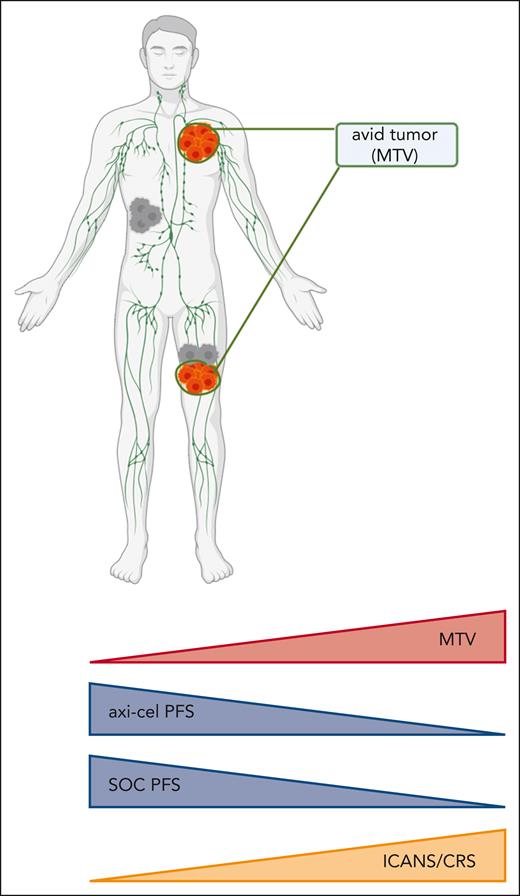 Correlation of metabolic tumor burden with clinical outcomes in the ZUMA-7 trial. ICANS/CRS, incidence of grade 3+ immune effector cell–associated neurotoxicity syndrome/cytokine-release syndrome; MTV, metabolic tumor volume; PFS, progression-free survival; SOC, standard-of-care high-dose chemotherapy with autologous stem cell transplant. Figure created with BioRender.com.