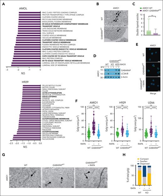 Loss of GABARAP impairs autophagy induction and alters Golgi morphology. (A) AMO1 and H929 WT and GABARAPKO were subjected to proteomic analysis by multiplexed proteomics with mass spectrometry. Shown in panel A is the gene set enrichment analysis (GSEA) gene ontology cellular components (GOCC) that were significantly negatively enriched after GABARAP KO. (FDR <1% for AMO1 and FDR <25% for H929). (B-C) Analysis of autophagy in AMO1 WT and GABARAPKO cells by TEM. (B) Representative TEM images depicting Golgi morphology (A = double-layered vesicles); scale bars, 500 nm. (C) Histograms showing the number of double-layered vesicles as determined in a total of 30 images for AMO1 WT and 30 images for AMO1 GABARAPKO cells. (D) AMO1 WT, GABARAPKO, and GABARAPKO in which GABARAP was re-expressed (GABARAPKO + add-back) were left untreated or treated with BTZ (5 nM; 16 hours). Immunoblot of GABARAP and LC3A/B is shown. β-Actin was used as a loading control. (E) Representative confocal images of Golgi apparatus stained with GM-130 antibody (green) in AMO1 WT, GABARAPKO, and GABARAPKO treated with rapamycin (50 nM; 24 hours). DAPI was used to label nuclei. This merged figure is also reported as supplemental Figure 4L together with the ones of the single channels; scale bars, 20 μm. (F) Box plot showing the Golgi area (μm2) in the different conditions as determined in a total of 119 cells per condition for AMO1, 60 cells per condition for H929, and 60 cells per condition for U266. (G) Representative TEM images depicting Golgi morphology in AMO1 WT, GABARAPKO, and GABARAPKO treated with rapamycin (50 nM; 24 hours) (C = compact; D = dispersed; and S = swollen); scale bars, 500 nm. (H) Histogram showing the percentage of compact, swollen, and dispersed Golgi in each condition. Specifically, 61 Golgi were visible in 29 TEM images taken in AMO1 WT; 37 Golgi in 30 TEM images taken in AMO1 GABARAPKO; and 47 Golgi in 29 TEM images taken in AMO1 GABARAPKO treated with rapamycin. For panel C, ∗∗P < .01 based on the unpaired Student t test; for panel F, ∗∗∗∗P < .0001 Kruskal-Wallis test. RAPA, rapamycin.