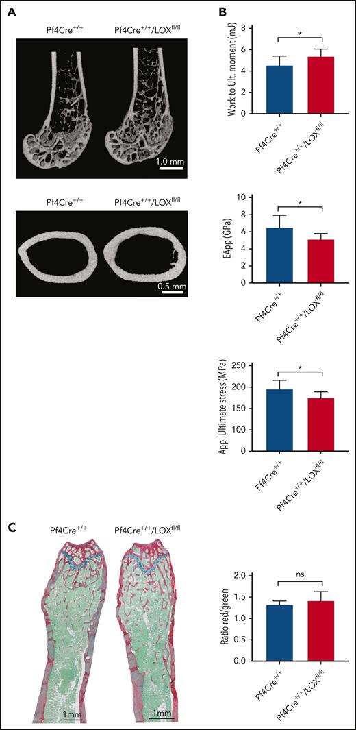 LOX deletion in MKs leads to changes in bone volume and mechanical strength in male mice. (A) Representative micro–computed tomography (μCT) images from femurs of Pf4Cre+/+/LOXfl/fl mice and matching controls. The upper panel shows a distal femoral metaphysis, and the lower panel shows a femoral middiaphysis. Nine Pf4Cre+/+/LOXfl/fl and 7 Pf4Cre+/+ 17-week-old male mice were analyzed. (B) Three-point bending of the femoral diaphysis from the same femurs used for μCT and histology. This assay determines bone mechanical properties. Work to maximum moment (mJ), apparent bending modulus (GPa), and apparent ultimate stress (MPa) are shown. The rest of the 3-point bending parameters can be found in supplemental Figure 6. Plots are mean ± SD for the above number of mice. ∗P < .05. (C) Quantitative analysis of the ratio osteoid (red)/mineralized bone (green) for trabecular bones. Femurs of Pf4Cre+/+/LOXfl/fl mice and matching controls were stained with picrosirius red, fast green, and alcian blue, providing discrimination between mineralized and unmineralized (osteoid) bone. Osteoid appears red, mineralized bone appears green, and cartilage appears blue. Measurements are presented as mean ± SD. Analysis of the trabecular bone was conducted 50 μm distant from the edge of the growth plate, extending 300 μm. Four Pf4Cre+/+/LOXfl/fl and 4 Pf4Cre+/+ 17-week-old male mice were analyzed. EApp, apparent modulus of elasticity; ns, not significant; Work to Ult moment, work to ultimate momentum.