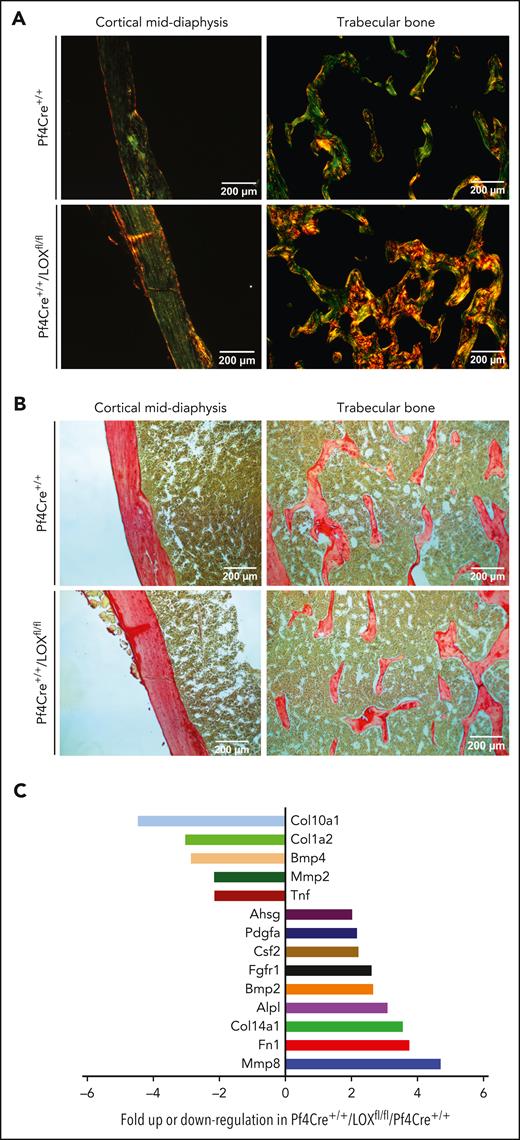 LOX deletion in male MKs impacts bone collagen structure but not level, with associated changes in MK gene expression. (A) Representative images of bone sections of Pf4Cre+/+ and Pf4Cre+/+/LOXfl/fl male mice stained with picrosirius red and visualized under polarized light. Picric acid can more easily dissolve into collagen fibers that are loosely packed, yielding a bright yellow birefringence, as observed under polarized light. When the stain is less able to penetrate collagen because of tight fibril packing, collagen profile appears less bright under polarized light, with birefringence mixed with evidence of green, yellow, and sometimes orange/red. Five Pf4Cre+/+/LOXfl/fl and 3 Pf4Cre+/+ 17-week-old male mice were analyzed. Images shown are representative of at least 3 slides analyzed in each case. (B) Representative images of bone sections of Pf4Cre+/+ and Pf4Cre+/+/LOXfl/fl male mice stained with picrosirius red and visualized under nonpolarized light for total collagen detection. Five Pf4Cre+/+/LOXfl/fl and 3 Pf4Cre+/+ 17-week-old male mice were analyzed. Images shown are representative of at least 3 slides analyzed in each case. (C) Differential expression of bone development–related genes in MKs of Pf4Cre+/+/LOXfl/fl mice compared with Pf4Cre+/+ mice with a graphical representation of >twofold difference in expression, using the commercial RT2 Profiler PCR Array Mouse Osteogenesis PAMM-026Z. mRNA results were normalized to β-actin, β-2 microglobulin, glyceraldehyde-3-phosphate dehydrogenase, β-glucuronidase, and heat shock protein 90-α. Eight 12-week-old control mice and 8 12-week-old Pf4Cre+/+/LOXfl/fl mice were analyzed. MKs derived from 4 mice in each experimental group were combined as 1 sample to obtain sufficient material and increase biological representation. Ahsg, alpha-2-HS-glycoprotein; Alp, alkaline phosphatase; Bmp, bone morphogenetic protein; COl, collagen; Csf, colony stimulating factor; Fgfr, fibroblast growth factor receptor; Fn, fibronectin; Mmp, matrix metallopeptidase; Pdgfa, platelet derived growth factor alpha; Tnf, tumor necrosis factor.