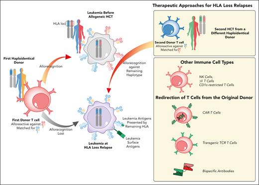 Therapeutic interventions to counteract genomic loss of the mismatched HLA haplotype after allo-HCT. Schematic representation of the genomic HLA loss relapse modality and of available therapeutic strategies to restore donor T-cell recognition of leukemia. Genomic loss of one HLA haplotype by CN-LOH under allo-immune pressure leads to leukemia immune evasion from donor T cells (in red) and subsequently to relapse (leukemia at diagnosis in gray, relapse in violet). To counteract HLA loss relapse, one of the therapies available is a second allo-HCT using an alternative, partially HLA-incompatible donor. A different haploidentical donor is, in fact, expected to have T cells (in blue) alloreactive against the haplotype conserved and duplicated by the relapsed leukemic blasts. Other potential approaches that are gaining increased attention include non-HLA restricted immunotherapies, including NK cells or CD1c-restricted lymphocytes, and redirection of T cells from the stem cell donor through bispecific antibodies or transgenic receptors.
