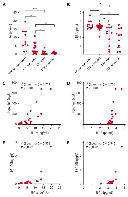 IL-1α and -1β concentrations in the plasma of patients with TTP; correlations with troponin and PS-100b concentrations. IL-1α (A) and IL-1β (B) plasma levels quantified by ELISA in TTP nonsurvivors (n = 10), TTP survivors (n = 20), in patients with TTP in remission (n = 10), and controls (n = 10). IL-1α plasma levels in nonsurvivors: 6.65 (4.39-13.64) pg/mL; in survivors: 1.72 (0.86-4.88) pg/mL; in control: 0.08 (0-1.64) pg/mL, and in those in remission: 0.72 (0.36-1.19) pg/mL. IL-1β plasma levels in nonsurvivors: 3.51 (3.20-3.93) pg/mL; in survivors: 3.34 (3.19-3.45) pg/mL; in control: 2.55 (0.87-3.22) pg/mL; and in those in remission 2.31 (0.82-3.12) pg/mL. Correlation between troponin T and IL-1α (C), or between troponin T and IL-1β plasma levels (D) in patients with TTP. Correlation between PS-100b and IL-1α (E), or between PS-100b and IL-1β (F) plasma levels in patients with TTP (∗P < .05, ∗∗P < .01, and ∗∗∗P < .001).