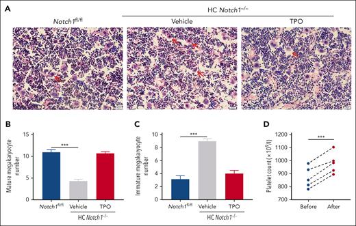 Impaired megakaryocyte maturation in hepatocyte Notch1-deficient mice. Femurs were isolated from Notch1fl/fl mice or HC Notch1−/− mice treated with vehicle or exogenous TPO (1 μg/kg) for consecutive 5 days and then fixed followed by H&E staining to evaluate megakaryocyte maturation and differentiation (A). Blue arrows indicate the mature megakaryocytes (defined as megakaryocytes having 4-16 nuclear lobes), and red arrows indicate the immature megakaryocytes (defined as megakaryocytes lacking lobulation of the nucleus or <4 nuclear lobes). The number of mature (B) or immature (C) megakaryocytes was quantified (mean ± SE; n = 6; 1-way ANOVA). (D) The number of circulating platelets was measured after supplementation of exogenous TPO (1 μg/kg) for consecutive 5 days (paired student t test). ∗∗∗P < .001.