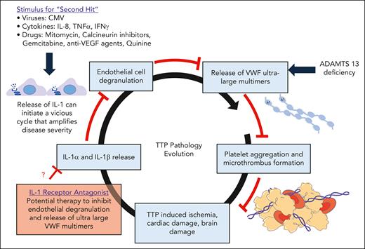 An IL-1–induced amplification loop in TTP. Release of ultralarge multimers in the absence of ADAMTS13 activity results in formation of platelet aggregates and microthrombi, causing ischemic injuries. This TTP-induced ischemia triggers the release of proinflammatory cytokines, such as IL-1, that can initiate damage, leading to amplification of disease severity. Anakinra-based IL-1 blockade is an appealing treatment that has been used effectively for a variety of autoimmune and inflammatory disease states and is effective in mitigating many pathophysiological features of TTP.