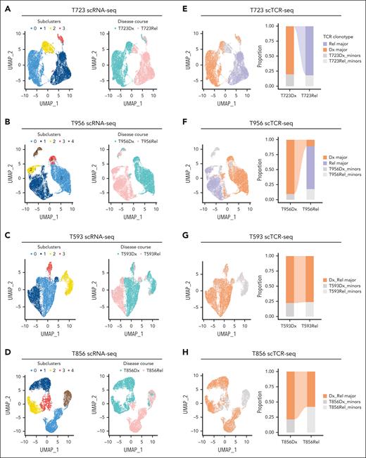 Clonal progression trajectory deconvolution from single-cell transcriptomic and single-cell TCR profiles of Dx_Rel T-ALL pairs. (A-D) UMAP plot of cell points clustered according to the overlaid gene signature identities (first column, clusters demarcated by color) and to disease course (second column, diagnostic identities in blue, relapsed identities in pink) for patients T723 (A), T956 (B), T593 (C), and T856 (D). (E-H) UMAP plot (left column) of cell points colored according to TCR-based genotyping identities for patients T723 (E), T956 (F), T593 (G), and T856 (H) at diagnosis and relapse. Subcluster colors represent the TCR clonotypes based on TCR CDR3 analysis. For patients T723 and T956, identities in orange represent major TCR clonotypes at diagnosis (Dx major); the identities in purple represent the major TCR clonotype at relapse (Rel major). For patients T593 and T856, cell identities with respectively identical TCR clonotypes persisting from diagnosis to relapse are denoted in orange. Other than the above-mentioned cell identities, the minor TCR clonotypes are all display in gray. Stacked bar plots of TCR-based clonotype compositions at diagnosis and relapse are displayed accordingly in the right column.