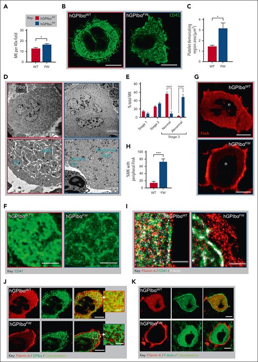 Disrupted GPIbα-flnA interaction results in megakaryocyte flnA redistribution and structural abnormalities in the DMS. (A) The number of MKs was quantified from H&E-stained femoral bone marrows (10 random fields; 40× objective) and results depict the mean ± SEM of 6 mice; ∗P < .05, unpaired t test. (B-C) Bone marrow MKs were stained with anti-CD41 (green) and imaged using STED microscopy. Representative STED images showing MK CD41 distribution within the DMS in hGPIbαWT and hGPIbαFW mice (93×; scale bars, 10 μm) (B). Quantification of the CD41-free areas within the DMS territories of hGPIbαWT and hGPIbαFW MKs. Individual platelet-delineating territories were identified by bright CD41 staining and surface area of the territories determined. Data were derived from 3 mice, with at least 5 MKs evaluated per mouse (C). (D-E) Mouse femurs were prepared for TEM and the structure of DMS evaluated within the MK cytoplasm. (D) Representative TEM images of hGPIbαWT and hGPIbαFW bone marrow MKs demonstrating impaired DMS development and absent peripheral zone in hGPIbαFW mice. Note, abnormal DMS formation in mature stage III hGPIbαFW MKs is marked by the lack of white space. Scale bars: top panel 5 μm, bottom panel 2 μm. (E) Bone marrow MK maturation was analyzed using TEM, with DMS classified according to stages I to III as defined under “Methods.” Results depict the mean ± SEM of 3 mice; ∗∗∗∗ P < .001 for strain comparison; 2-way ANOVA. (F) Regions of the DMS were evaluated using high magnification of STED images from (B), highlighting thinner and sparser CD41+ membranes in hGPIbαFW mice (Scale bars, 2 μm). (G-H) The distribution of flnA in hGPIbαWT and hGPIbαFW bone marrow MKs by STED microscopy. (G) Quantification of the percentage (%) of MKs with peripheral distribution of flnA. Results are the mean ± SEM of 30 to 40 MKs from 4 pairs of mice; ∗∗∗∗P < .0001, unpaired t test. (H) Representative STED images showing homogeneous and peripheral flnA distribution within MKs in hGPIbαWT and hGPIbαFW mice, respectively (93×; scale bars, 10 μm). (I) GSD microscopy was performed on 3 μm femoral bone marrow cryosections that were stained with fluorescently labeled phalloidin, anti-CD41 and anti-flnA Abs. Representative GSD images showing peripheral flnA accumulation and loss of colocalization with F-actin and CD41 in hGPIbαFW MKs relative to hGPIbαWT mice (160× oil objective; scale bars, 1 μm). (J-K) hGPIbαWT and hGPIbαFW mouse bone marrow cryosections were stained with anti-flnA and GPIbα Abs and phalloidin. Representative STED images demonstrating peripheral flnA and the loss of its colocalization with GPIbα (J) and F-actin (K) in hGPIbαFW MKs, in contrast to hGPIbαWT cells (93× glycerol objective; scale bars, 10 μm). Ab, antibody; ANOVA, analysis of variance; H&E, hematoxylin and eosin; SEM, standard error of the mean.