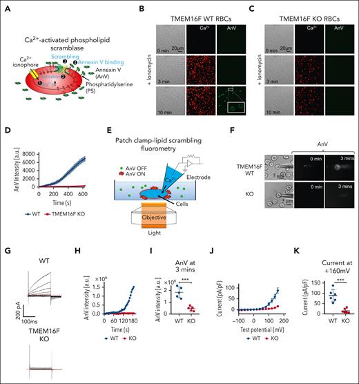 TMEM16F is responsible for Ca2+–activated lipid scrambling in murine RBCs. (A) Schematic of the fluorescence lipid scrambling assay in RBCs. (B-C) Ca2+ (red)–induced phosphatidylserine (PS) exposure (AnV, green) in the RBCs from TMEM16F wild-type (WT; B) and TMEM16F knockout (KO; C) mice. Ten micromolar ionomycin was used to trigger Ca2+ influx and subsequent lipid scrambling. White boxes show an enlarged view. (D) Time-dependent lipid scrambling reported by AnV in the TMEM16F WT and KO murine RBCs induced by ionomycin. Error bars represent standard error of the mean (SEM). WT (n = 16 cells) and KO (n = 15 cells) from at least 3 biological replicates. (E) Schematic of PCLSF assay to simultaneously monitor TMEM16F lipid scramblase and ion channels activities (see “Methods” for details). (F) Representative images of lipid scrambling activity in WT and TMEM16F-KO RBCs under PCLSF. PS exposure was detected by membrane binding of the fluorescent AnV conjugates. (G) Representative current traces in WT and TMEM16F-KO RBCs elicited by a voltage step protocol from –100 mV to +160 mV with 20 mV increment. The currents were recorded ∼2.5 minutes after the whole-cell patches were established. (H) Representative time course of AnV signal on WT and TMEM16F-KO RBCs. (I) Fluorescence intensity of AnV signal at 3 minutes. Two-sided Student t test, ∗∗∗P < .001 (n = 5). (J) I-V relationship of the currents recorded in (G). The currents were normalized to cell capacitance. The results are presented as mean ± SEM (n = 6). (K) Current density at +160 mV. The results are presented as mean ± SEM. Two-sided Student t test, ∗∗∗P < .001 (n = 6).