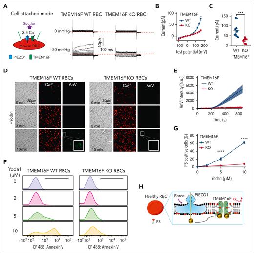Ca2+ influx through PIEZO1 activates TMEM16F in murine RBCs. (A) Representative cell-attach patch-clamp recording (schematic on left) in TMEM16F WT and knockout (KO) murine RBCs with 0 and –50 mmHg suction. The membrane was depolarized by voltage steps from –100 mV to +160 mV with 20 mV increment. A total of 2.5 mM Ca2+ in the pipette and a holding voltage at –60 mV enable Ca2+ influx and subsequent activation of TMEM16F current. (B) I-V relationship of the current recorded in A. (C) Statistical analysis of current at +160 mV. The results are presented as mean ± SEM. Two-sided Student t test, ∗∗∗P < .001 (n = 12 for WT and 10 for KO). (D) Representative images of 10 μM Yoda1-induced Ca2+ increase (red) and lipid scrambling (AnV, green) in RBCs from TMEM16F WT (left) and KO (right) mice. White boxes show enlarged views. (E) Time-dependent lipid scrambling reported by AnV in the RBCs from TMEM16F WT and KO mice stimulated by Yoda1. Error bars represent SEM. At least 3 biological repeats were done for WT (n = 18) and KO (n = 19) groups. (F) Flow cytometry quantification of Ca2+–induced lipid scrambling (reported by AnV 488) in WT (left) and TMEM16F-KO (right) murine RBCs in response to different concentrations of Yoda1. The y-axis represents cell counts. (G) Quantification of the percentage of PS-positive RBCs in response to different concentrations of Yoda1. Error bars represent SEM. The statistical analysis was done with 2-way analysis of variance followed by Sidak multiple comparisons tests, ∗∗∗∗P < .0001, n = 6 to 9 repeats for WT and KO RBCs at each dose. (H) Cartoon illustration of PIEZO1-TMEM16F coupling in healthy RBCs. Ca2+ influx through PIEZO1 activates TMEM16F in the vicinity.