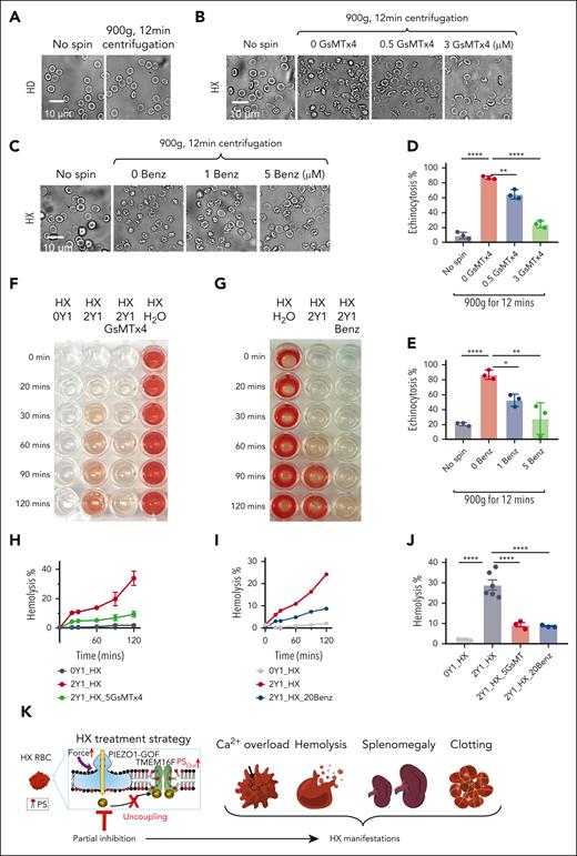 Inhibition of PIEZO1 prevents echinocytosis and hemolysis in HX001 RBCs. (A) Representative images of RBCs from a HD before and after centrifugation. (B-C) Representative images of the RBCs from HX001 with various concentrations of GsMTx-4 (B) and Benz (C) before and after centrifugation. (D-E) Effect of GsMTx-4 (D) and Benz (E) on spin-induced RBC echinocytosis (see “Methods” for details). (F) Representative photos of 2 μM Yoda1(Y1)-induced hemolysis in HX RBCs with and without 5 μM GsMTx-4. 0 Yoda1 (left) and H2O (right) serve as negative and positive controls, respectively. (G) Representative images of 2 μM Yoda1-induced hemolysis with and without 20 μM Benz at different time points as indicated. (H) Time course of 2 μM Yoda1(Y1)-induced with and without 5 μM spider toxin GsMTx-4 in HX001 RBCs. Results were normalized to the water-induced fully lysed group. (I) Time course of 2 μM Yoda1 (Y1)-induced hemolysis with and without 20 μM Benz in HX001 RBCs. Results were normalized to the water-induced fully lysed group. (J) Yoda1-induced RBCs hemolysis percentage at 120 minutes with and without GsMTx-4 and Benz. Unpaired 2-sided Student t test, ∗∗∗∗P < .0001, n = 3 to 6 repeats for each condition. (K) Partially inhibiting PIEZO1 can effectively disrupt PIEZO1-TMEM16F coupling in HX RBCs and prevent HX-associated complications.