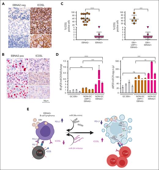 ICOSL and miR-24 expression in DLBCL clinical tissues. (A) Three EBV-negative non-GC DLBCLs immunohistochemically stained for EBNA2 and ICOSL are shown. Cell membrane ICOSL positivity is in brown. These samples are negative for EBNA2. (B) Three cases of EBNA2-positive non-GC DLBCL and corresponding ICOSL expression are shown. Nuclear EBNA2 is shown in red. ICOSL is negative. (C) Scattered dot plot analysis representing ICOSL-positive cells in each case. The stained tissue sections were digitalized at a ×40 original magnification using Ventana DP200 Scan Scope. The number of positive cells was determined by manually counting 6 different areas and at least 100 cells in each area. For statistical significance, a 2-tailed unpaired t test was used; ∗P < .05, ∗∗∗∗P < .0001. (D) miR-24 expression and copy number in DLBCLs by RT-qPCR (left panel) and ddPCR (right panel). Statistical significance was calculated with two-way ANOVA and Tukey multiple comparisons test; ∗∗P < .01, ∗∗∗P < .001, ∗∗∗∗P < .0001. (E) miRNA-based immunotherapy of EBV-associated EBNA2-expressing B-cell lymphoma. A proposed model underscoring the use of PD-L1, targeting miR-34a mimics as suggested by our previous data38 in combination with anti–miR-24 molecules to reconstitute ICOSL as an RNA-based immunotherapeutic approach (created with BioRender.com). Panel E is reproduced from Blandino et al,56 licensed under a Creative Commons Attribution 4.0 International License (https://creativecommons.org/licenses/by/4.0/).