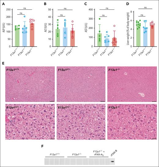 FXIII-A2 is not required for FXIII-B2 secretion from mouse liver. Serum alkaline phosphatase (ALP) (A), alanine transaminase (ALT) (B), and aspartate transaminase (AST) (C) levels were determined in F13a1+/+, F13a1+/−, and F13a1–/– mice; liver weight (D) in F13a1+/+, F13a1+/−, and F13a1–/– mice, reported as a percentage of body weight. Dots represent individual mice, bars show mean ± standard deviation. Groups were compared by 1-way ANOVA with Dunnett post hoc testing (A-D). (E) Histology of liver tissue from F13a1+/+, F13a1+/−, and F13a1–/– mice. Sections were stained with hematoxylin and eosin. Representative low (top) and high (bottom) magnification images are shown. Scale bar indicates 100 μm (top) and 20 μm (bottom). (F) FXIII-B antigen in liver tissue lysates from F13a1+/+, F13a1–/–, and rFXIII-A2–treated F13a1–/– was visualized by immunoblotting with anti–FXIII-B antibody. Lysates were normalized by protein concentration and the same amount of total protein was loaded for each sample. Each lane shows 1 mouse. Recombinant FXIII-B (rFXIII-B) was included as a standard. ANOVA, analysis of variance; ns, nonsignificant; U/L, units/liter.