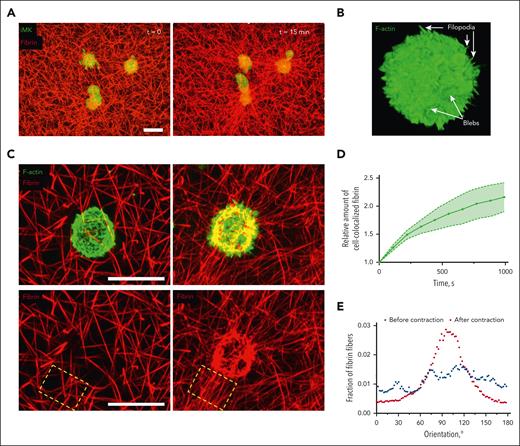 Structural bases of the interactions of thrombin-stimulated iMKs with a fibrin network during contraction of a plasma clot. (A) Representative confocal microscopy images of calcein-labeled iMKs (green) and Alexa fluor–labeled fibrin network (red) before (left) and at 15 minutes (right) of clot contraction. The images are projections of 26-μm z-stacks. Scale bar, 20 μm. See also supplemental Video 2. (B) A representative confocal microscopy image of an individual thrombin-stimulated iMK stained for F-actin within a clot fixed immediately after formation. Arrows show filopodia and blebs on the surface of the iMK. (C, upper panel) A thrombin-stimulated individual iMK embedded into the fibrin network fixed at the 0 point (left) and at 15 minutes (right) of clot contraction. (C, bottom panel) Deformation, radial orientation of fibrin fibers, and compaction of fibrin are caused by the contracting iMK shown on the upper panel (the red fluorescence channel only). Scale bars, 20 μm. (D) Temporal increase of the amount of fibrin accumulated on individual iMKs over the course of contraction, measured as a relative amount of iMK-colocalized fibrin in confocal microscopy z-stacks of clots (n = 20; mean ± 95% CI). (E) A representative diagram showing orientation of fibrin fibers in the selected field in C (dashed rectangle) in the vicinity of a contracting iMK. CI, confidence interval.