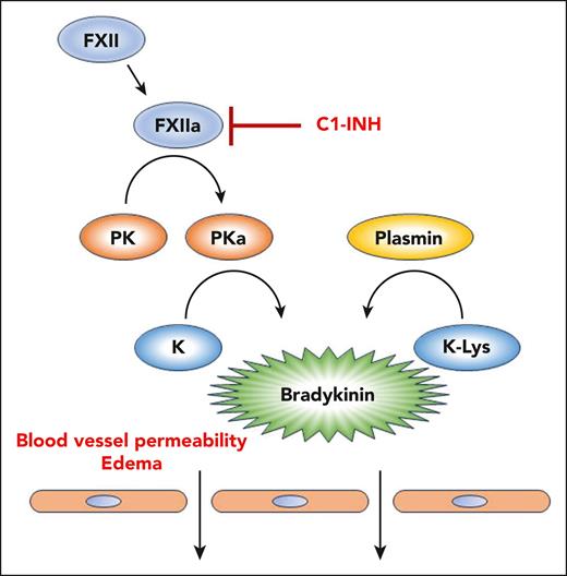 The kallikrein-kinin system and HAE. Activation of FXII to FXIIa leads to conversion of plasma prekallikrein (PK) to active plasma kallikrein (PKa). PKa can cleave high- and low-molecular-weight kininogens (K) to release bradykinin. Under normal conditions, C1-INH inhibits FXIIa and prevents propagation of the pathway. Many cases of HAE are caused by insufficient or inactive C1-INH. The article by Dickeson et al shows that a methionine-to-lysine missense mutation in kininogen (K-Lys), identified in a family of patients with HAE, renders it susceptible to cleavage by the fibrinolytic protease plasmin. This mutation thus causes excessive bradykinin formation and can lead to HAE.