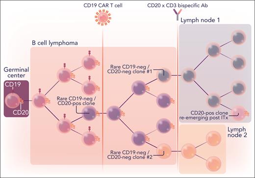 Branching evolution of B-cell lymphomas surviving successive rounds of CD19- and CD20-directed immunotherapies. B-cell lymphomas originate in germinal centers of the secondary lymphoid organs and are originally CD19/CD20 double-positive. Upon immunotherapy (ITx) with CD19-directed CAR T cells and/or bispecific CD20xCD3 T-cell engagers (represented by vertical lines), they routinely lose 1 or both antigens. However, CD20+ clones can reemerge in some of the distant lymph nodes upon discontinuation of ITx. The dendrogram illustrates one of the cases described by Duell et al. Ab, antibody; neg, negative; pos, positive. Professional illustration by Somersault18:24.