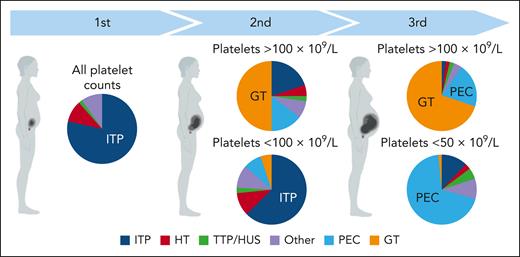 Causes of thrombocytopenia by trimester and severity. HT, hereditary thrombocytopenia; PEC, preeclampsia; TTP/HUS, thrombotic thrombocytopenic purpura/hemolytic uremic syndrome. The figure was modified from Cines and Levine.6