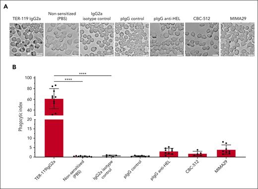 AMIS-inducing antibodies do not trigger significant macrophage phagocytosis of RBCs. PKH67+HOD-RBC were sensitized with TER119, which induces a robust level of phagocytosis.32 In comparison, additional RBCs were sensitized with anti-HOD antibodies (pIgG anti-HEL, or anti-Duffy CBC-512 IgG2a, or MIMA29 IgG2a), a mouse IgG2a isotype control, mouse pIgG nonspecific, or kept nonsensitized (PBS). RAW macrophages were stimulated with nonsensitized or sensitized RBC for 30 minutes at 37°C and 5% CO2. External, nonphagocytosed RBCs were removed by hypotonic (water) lysis. (A) Brightfield microscopy images of macrophages from each condition are shown. The white arrows indicate an example of macrophages with phagocytosed RBCs. Pictures are representative of 5 independent experiments. (B) The phagocytic index was calculated as the number of RBCs engulfed per 100 macrophages. Data represent the mean ± SEM of 5 independent experiments with total number of samples per group (n = 5-10). Statistical analyses of the data represented in the graph of panel B were performed by one-way ANOVA with Sidak multiple comparisons post hoc test (∗∗∗∗P = .0001).