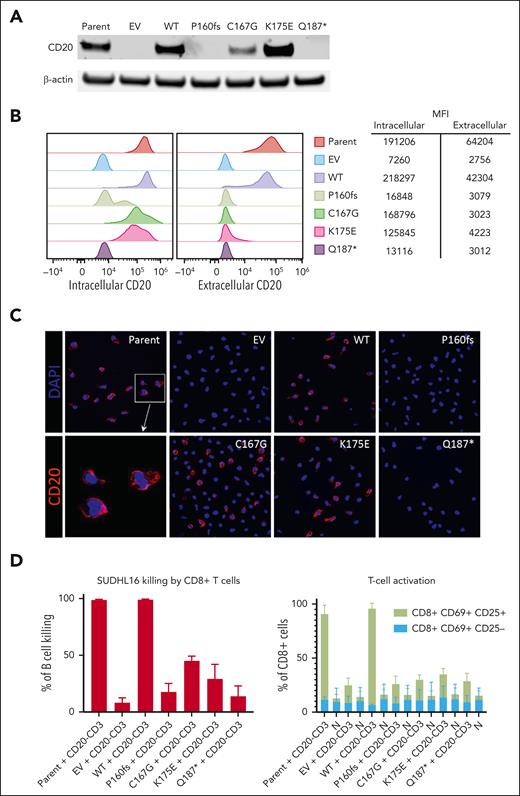 In vitro assessment of the effects of MS4A1 variants on CD20 expression and CD20 × CD3 activity. (A) CD20 protein expression by western blot in the SU-DHL-16–engineered cell lines. (B) Detection of CD20 by flow cytometry in SU-DHL-16–engineered cell lines. Intracellular expression was detected after permeabilization using anti-CD20 antibody targeting the C-terminus (H-1, BD-561174), and extracellular expression was detected using anti-CD20 antibody targeting ECL2 (2H7, BD-555623). (C) Immunofluorescence detection of CD20 using an intracellular antibody (ABCAM-78237): red fluorescence = CD20; blue fluorescence = 4′,6-diamidino-2-phenylindole (DAPI). (D) (left) CD20 × CD3–directed CD8-dependent cell killing of SU-DHL-16–engineered cell lines after 48 hours of treatment assessed by spectral flow cytometry. (Right) CD20 × CD3–directed CD8+ T-cell activation after 48 hours of treatment. T-cell activation monitored by flow cytometry by detecting activation markers CD69 and CD25. Flow cytometry data are represented as mean ± SD of 3 replicates. EV, empty vector; CD20-CD3, proof-of-concept CD20 × CD3 bispecific molecule; MFI, median fluorescence intensity; N, non-targeting control/CD3 antibody; parent, parental cell line; SD, standard deviation.