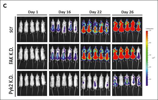 Pyk2 silencing decreases MM tumor growth in a mouse xenograft model. (C) SCID/Beige mice were injected IV with GFP+/Luc+-MM.1S Pyk2-knockdown (A4) or FAK-knockdown cells (3 × 106/mouse) to establish an MM xenograft model (n = 5 per group). Tumor burden was detected and quantified using BLI. Inhibition of Pyk2 significantly reduced MM tumor burden compared with scramble control. One mouse in the day 26 FAK-K.D. image was excluded from the analysis due to poor IV injection of luciferin for that mouse.