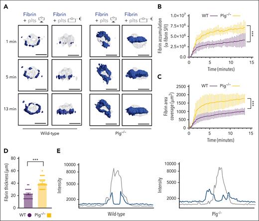 Increased fibrin accumulation at sites of hemostatic plug formation in plasminogen-deficient mice. (A) Representative images for fibrin (blue) and platelet (gray) accumulation at the indicated time points after laser injury in WT (left panel) and Plg−/−mice (right panel). (B) SFI ± SEM for fibrin signal. (Plg−/−, n = 15 injuries in 4 mice; and WT, n = 19 injuries in 3 mice). Same controls as in Figure 2F. (C) Fibrin area coverage (μm2). (D) Fibrin ring thickness (μm) measured at t = 13 minutes after laser injury. (E) Overlay of fluorescence intensity histograms for platelets (gray) and fibrin (blue) in plugs from a WT (left panel) or Plg−/− mouse (right panel), measured along 1 cross-section slice of a Z-max projection. Statistical significance was determined for fluorescence signals of the last 3D stack acquired during the observation period. ∗∗∗P < .001. Scale bar indicates 50 μm.